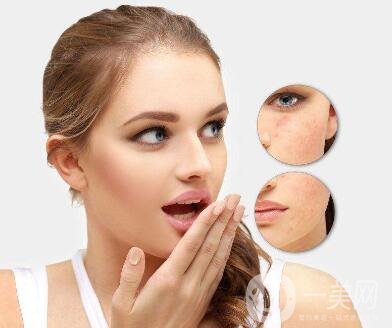 激光嫩膚價格一般是多少？*果好不好？