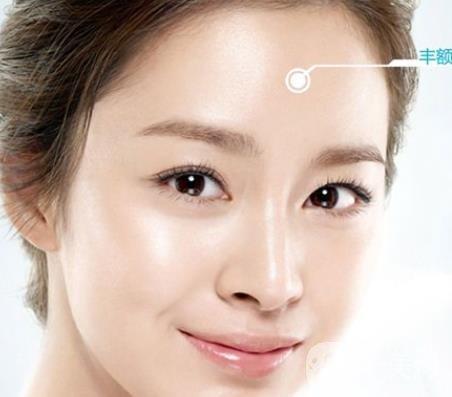 隆額頭材料哪種比較好？要多少錢？