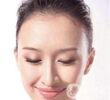 隆額頭材料哪種比較好？要多少錢？