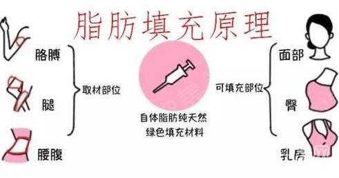 自身脂肪填充面部多久恢復(fù)?手術(shù)之后要注意?