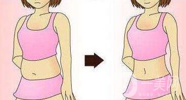 腹壁整形多少錢？費(fèi)用詳細(xì)解說