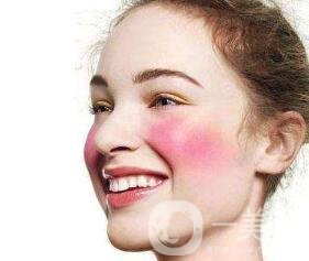 激光收毛孔能維持多久？