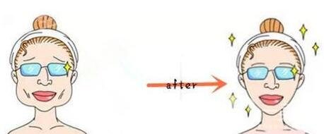 去咬肌手術(shù)多少錢?貴不貴?