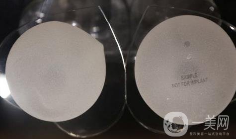 娜綺麗假體隆胸后多久可以變軟？