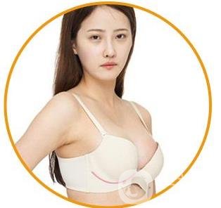 娜綺麗假體隆胸后多久可以變軟？