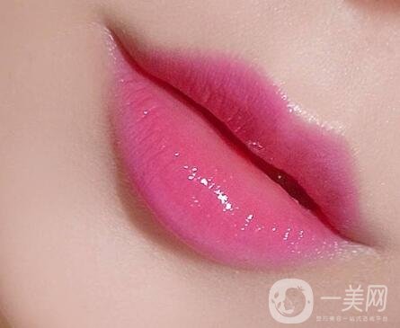 玻尿酸豐唇珠能夠保持多久？需要繼續(xù)注射嗎？