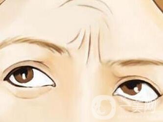 去川字紋快速*的方法介紹