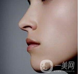 骨粉隆鼻后遺癥是什么樣的？