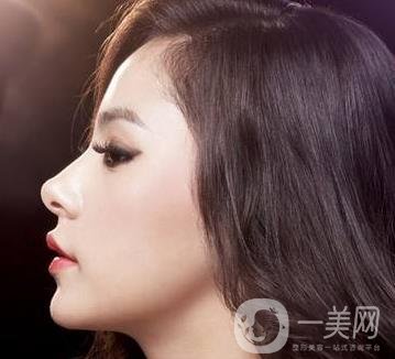 骨粉隆鼻后遺癥是什么樣的？