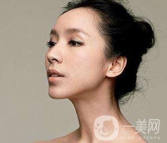 骨粉隆鼻后遺癥是什么樣的？