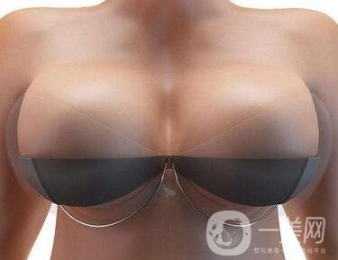 自身脂肪移植隆胸術(shù)有沒有副作用？