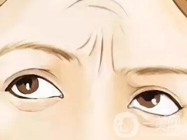 提升除皺手術(shù)多少錢?價格會有變化嗎