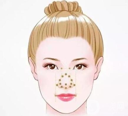 伊凡露注射隆鼻的*果能維持多久?需要注意什么嗎