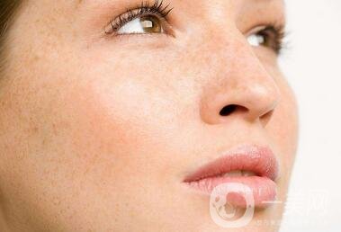 祛斑手術(shù)價格貴不貴？要多少錢？