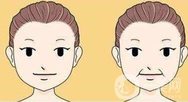 冰電波拉皮除皺*果如何？有哪些優(yōu)點(diǎn)？