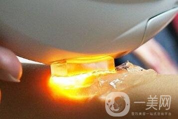 彩光嫩膚的價格一般是多少？