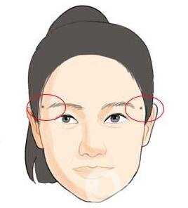 點(diǎn)痣后注意事項(xiàng)一定要遵守，否則會留疤！