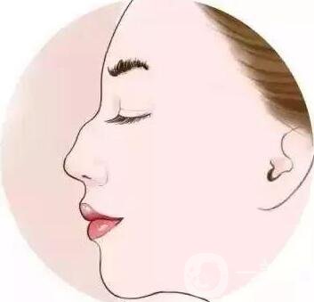 如何讓鼻梁變高？可以注射玻尿酸嗎？