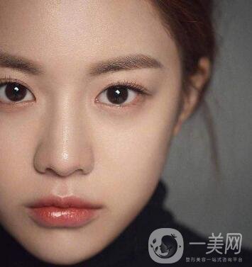 如何讓鼻梁變高？可以注射玻尿酸嗎？