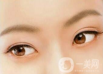 三點(diǎn)定位雙眼皮手術(shù)后應(yīng)該注意些什么？