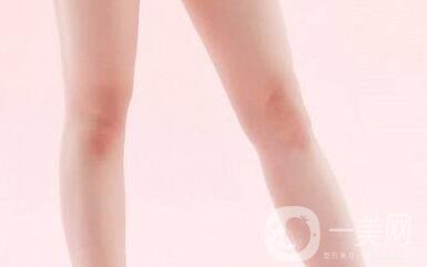 大腿部吸脂塑形術(shù)后護(hù)理的那些事兒