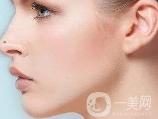 墊個鼻子要多少錢？大概價位是多少？