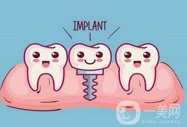 貴金屬烤瓷牙有哪些種類？