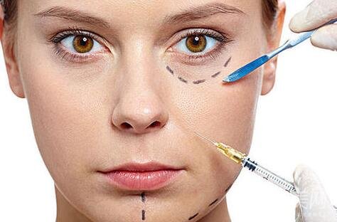 *祛皺對法令紋*嗎?能保持多久?