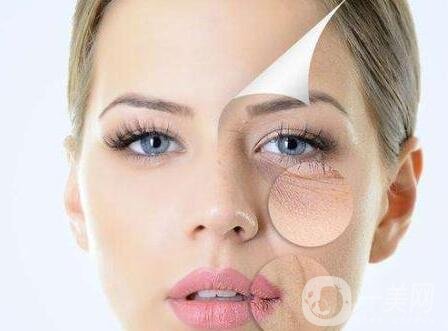 *去皺多久能見(jiàn)*?*果能維持多久?