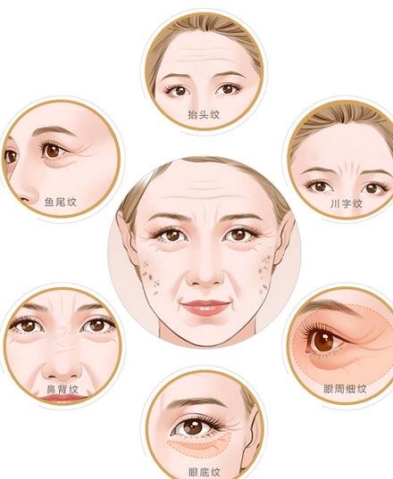 *去皺多久能見(jiàn)*?*果能維持多久?