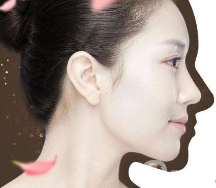 韓式立體隆鼻術(shù)的*果怎么樣？