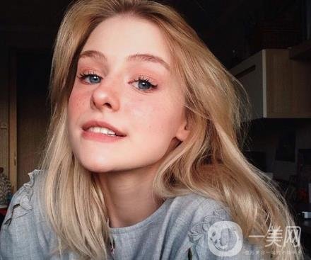 紅寶石激光祛斑多少錢(qián)？術(shù)后怎么護(hù)理？