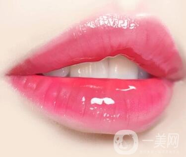 豐唇手術(shù)價(jià)格貴不貴？要多少錢(qián)？