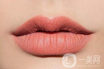 豐唇手術(shù)價(jià)格貴不貴？要多少錢(qián)？