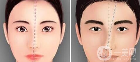 鼻梁矯正手術(shù)紗布取出后還會(huì)塌陷嗎?