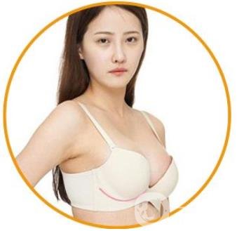 娜綺麗隆胸多久變軟？怎么加速變軟？