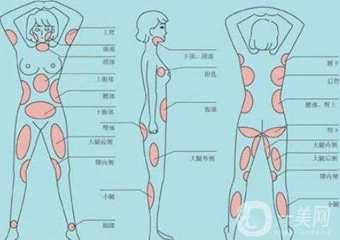 全身抽脂減肥多少錢？貴嗎？