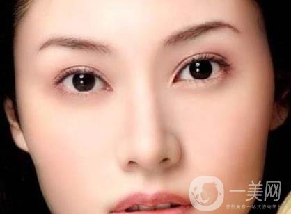 吸雕雙眼皮手術(shù)是什么？是埋線嗎？