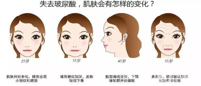 注射瑞藍玻尿酸價格是全國統(tǒng)一的嗎?有哪些區(qū)別