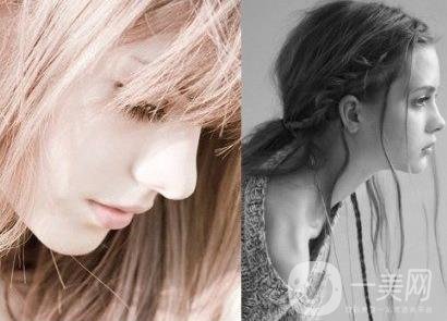 怎樣讓鼻子變高？隆鼻可以讓鼻子變高嗎？