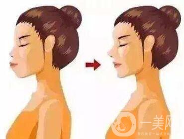 雙頜前突帶牙套可以矯正嗎？