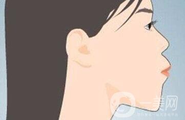 雙頜前突帶牙套可以矯正嗎？