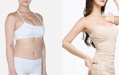 全身抽脂手術(shù)要多久？要花多少錢？