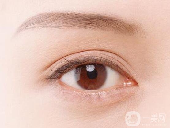 做埋線(xiàn)雙眼皮幾天能消腫?注意事項(xiàng)盤(pán)點(diǎn)全在這了!