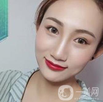 長沙微恩醫(yī)療整形醫(yī)院 隆鼻