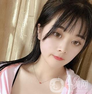 蘭州美奧整形醫(yī)院耳軟骨隆鼻