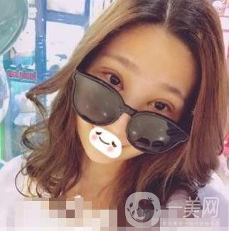 濟(jì)南旭美整形醫(yī)院靠譜嗎?附雙眼皮案例和全新價(jià)格表