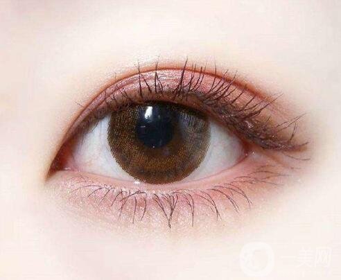 雙眼皮拆線后多久可以洗臉?用冷水還是熱水?