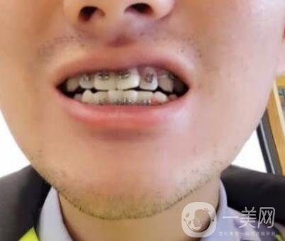 濰坊市人民醫(yī)院 整牙齒