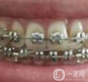 張家港澳洋醫(yī)院整牙